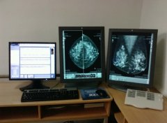 乳腺癌骨转移：全身热疗联合P53基因治疗有效控制病情