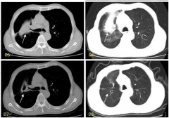 给胡主任医护团队的一封信 给胡主任医护团队的一封信